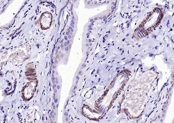 SM22 Alpha Rabbit Polyclonal Antibody
