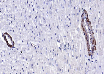 SM22 Alpha Rabbit Polyclonal Antibody