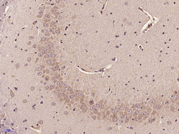 SOCS2 Rabbit Polyclonal Antibody