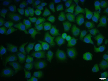 SREBP2 Rabbit Polyclonal Antibody