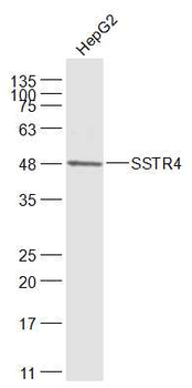SSTR4 Rabbit Polyclonal Antibody