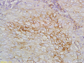STEAP1 Rabbit Polyclonal Antibody