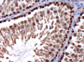 Stra8 Rabbit Polyclonal Antibody