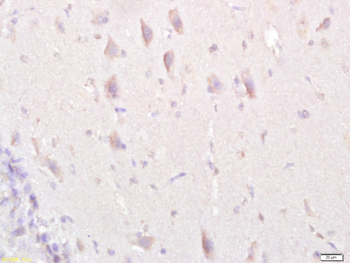 MAP1A Rabbit Polyclonal Antibody