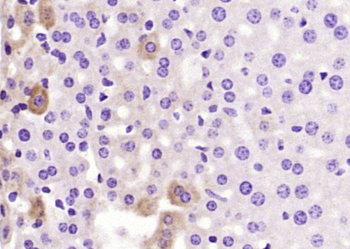 Thrombin heavy chain Rabbit Polyclonal Antibody