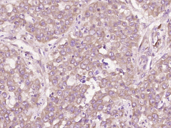 CD97 Rabbit Polyclonal Antibody