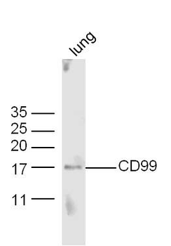 CD99 Rabbit Polyclonal Antibody