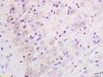 TLR1 Rabbit Polyclonal Antibody