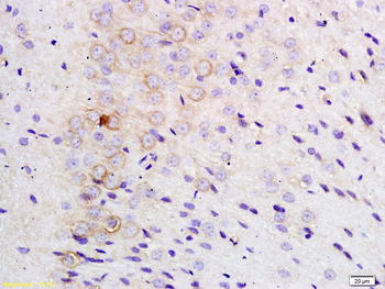 TLR1 Rabbit Polyclonal Antibody