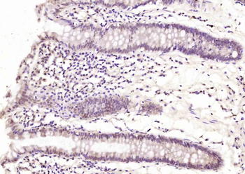 TNFAIP1 Rabbit Polyclonal Antibody