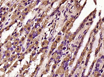 TOP2A Rabbit Polyclonal Antibody