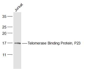 Telomerase Binding Protein, P23 Rabbit Polyclonal Antibody
