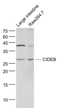 CIDEB Rabbit Polyclonal Antibody