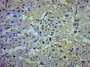 TWIST Rabbit Polyclonal Antibody