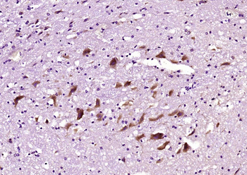 ITPR3 Rabbit Polyclonal Antibody