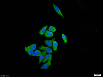 UCP-2 Rabbit Polyclonal Antibody