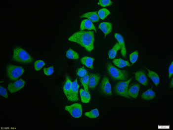 UCP-2 Rabbit Polyclonal Antibody