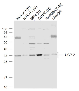 UCP-2 Rabbit Polyclonal Antibody