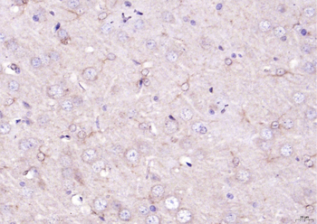 Versican Rabbit Polyclonal Antibody