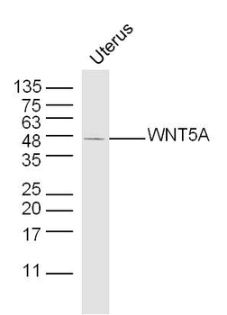 WNT5A Rabbit Polyclonal Antibody