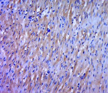 WRCH1 Rabbit Polyclonal Antibody