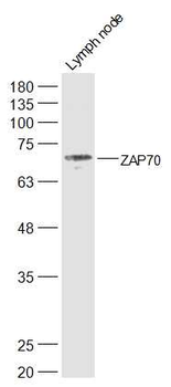 ZAP70 Rabbit Polyclonal Antibody