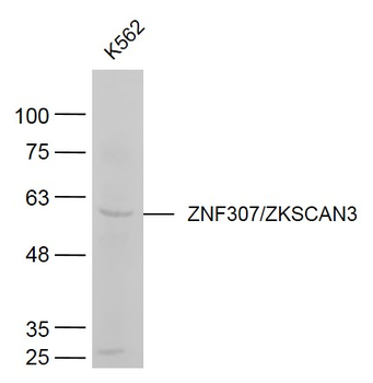 ZNF307/ZKSCAN3 Rabbit Polyclonal Antibody