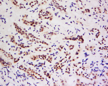 ZNF307/ZKSCAN3 Rabbit Polyclonal Antibody