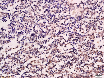 ZNF307/ZKSCAN3 Rabbit Polyclonal Antibody