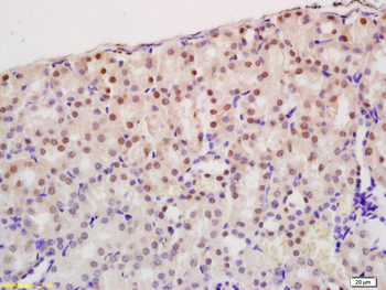 ZNF307/ZKSCAN3 Rabbit Polyclonal Antibody