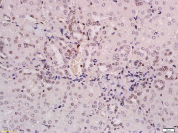 ZNF307/ZKSCAN3 Rabbit Polyclonal Antibody