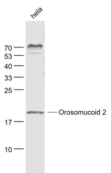 Alpha 1 acid glycoprotein 2 Rabbit Polyclonal Antibody