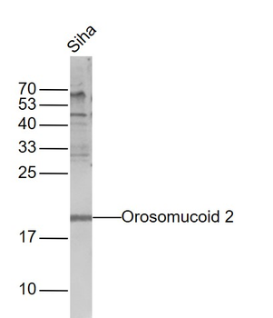 Alpha 1 acid glycoprotein 2 Rabbit Polyclonal Antibody