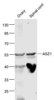 ASZ1 Rabbit Polyclonal Antibody