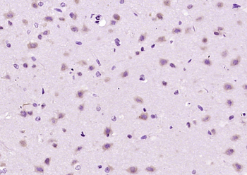 C2orf43 Rabbit Polyclonal Antibody