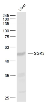 SGK3 Rabbit Polyclonal Antibody