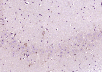RNF70 Rabbit Polyclonal Antibody
