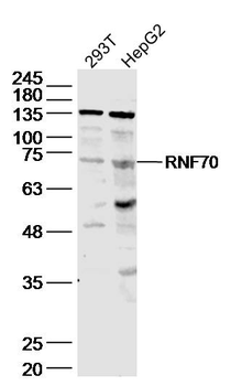 RNF70 Rabbit Polyclonal Antibody