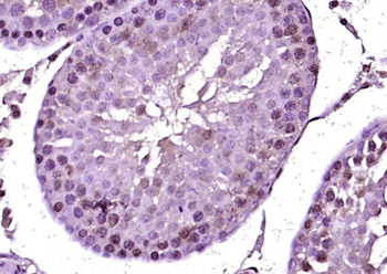 NOP2 Rabbit Polyclonal Antibody