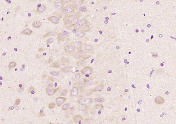 Proteasome 26S S3 Rabbit Polyclonal Antibody