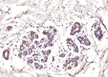 Proteasome 20S C2 Rabbit Polyclonal Antibody