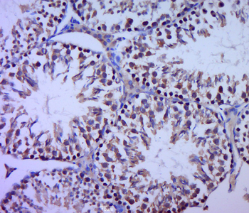 Phospho-GSK3A (Ser21) Rabbit Polyclonal Antibody