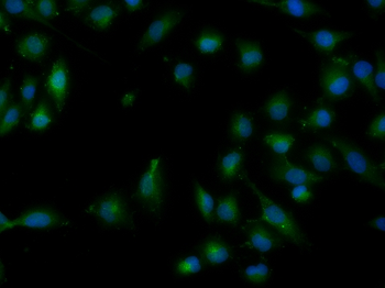 NADPH oxidase 4 Rabbit Polyclonal Antibody