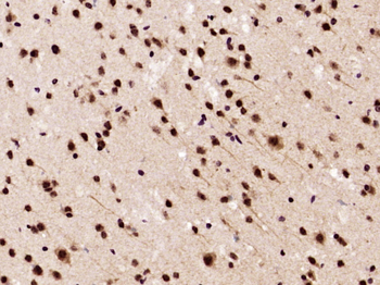 Phospho-Akt (Thr308) Rabbit Polyclonal Antibody