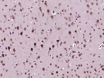 Phospho-Akt (Thr308) Rabbit Polyclonal Antibody