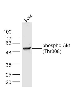 Phospho-Akt (Thr308) Rabbit Polyclonal Antibody