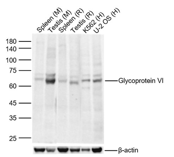 Glycoprotein VI Rabbit Polyclonal Antibody