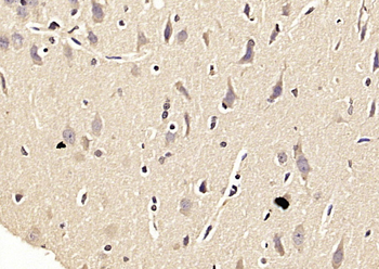 STIP1 Rabbit Polyclonal Antibody