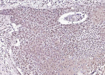 Phospho-SRF (Ser77) Rabbit Polyclonal Antibody