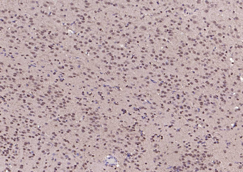 Phospho-SRF (Ser77) Rabbit Polyclonal Antibody